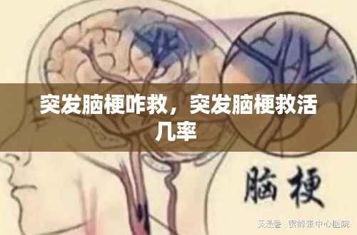 突发脑梗咋救,突发脑梗救活几率